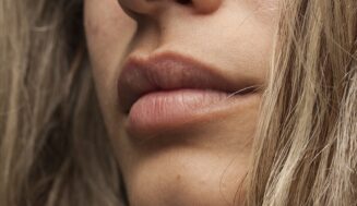 Permalip implants: implants, Procedure